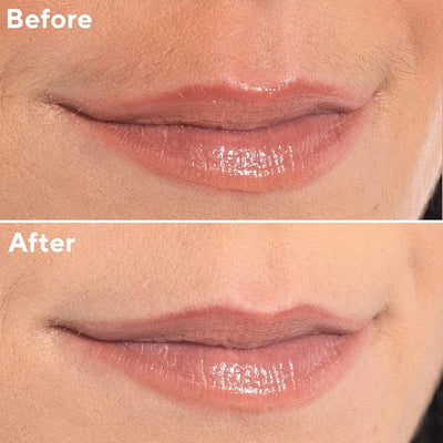 Facial Hair Remover for Women, Rose Gold Electric Face Razor with LED Light, Recyclable Packaging